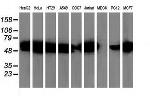 SQSTM1 Antibody in Western Blot (WB)