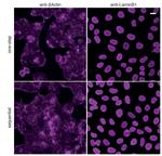 Human IgG/Rabbit IgG VHH Secondary Antibody in Immunocytochemistry (ICC/IF)