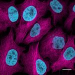 Human IgG/Rabbit IgG VHH Secondary Antibody in Immunocytochemistry (ICC/IF)