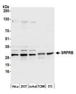 SRPRB Antibody in Western Blot (WB)