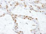 SS-B Antibody in Immunohistochemistry (IHC)