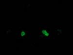 SSX1 Antibody in Immunocytochemistry (ICC/IF)