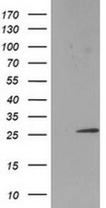 SSX1 Antibody in Western Blot (WB)