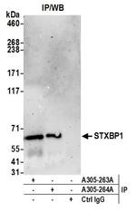 STXBP1/MUNC18-1 Antibody in Western Blot (WB)