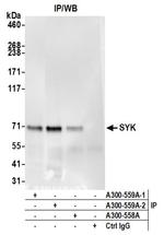 SYK Antibody in Western Blot (WB)