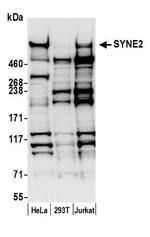 SYNE2/Nesprin 2 Antibody in Western Blot (WB)