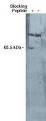 SGPL1 Antibody in Western Blot (WB)