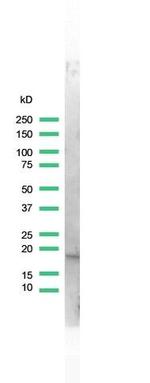 Stathmin 1 Antibody in Western Blot (WB)