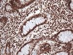 EWSR1 Antibody in Immunohistochemistry (Paraffin) (IHC (P))