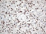 EWSR1 Antibody in Immunohistochemistry (Paraffin) (IHC (P))