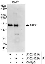 TAF2 Antibody in Immunoprecipitation (IP)
