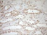 TCP10 Antibody in Immunohistochemistry (Paraffin) (IHC (P))