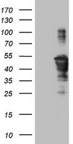 TCP10 Antibody in Western Blot (WB)