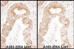 TFAM Antibody in Immunohistochemistry (IHC)