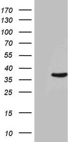 THAP8 Antibody in Western Blot (WB)