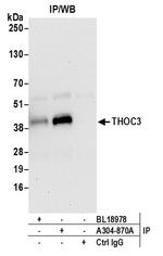 THOC3 Antibody in Western Blot (WB)