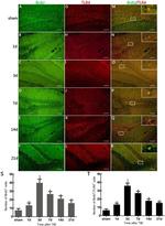 TLR4 Antibody in Immunohistochemistry (Paraffin) (IHC (P))