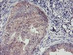 TMEFF2 Antibody in Immunohistochemistry (Paraffin) (IHC (P))