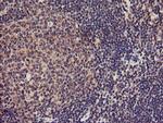 TMEFF2 Antibody in Immunohistochemistry (Paraffin) (IHC (P))