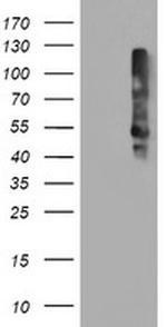 TMEFF2 Antibody in Western Blot (WB)