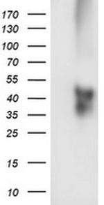 TMEFF2 Antibody in Western Blot (WB)