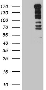 TOPBP1 Antibody in Western Blot (WB)