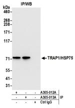 TRAP1/HSP75 Antibody in Western Blot (WB)
