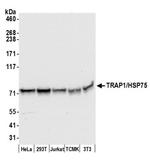 TRAP1/HSP75 Antibody in Western Blot (WB)