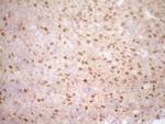 TRIB3 Antibody in Immunohistochemistry (Paraffin) (IHC (P))