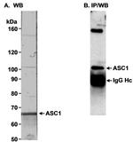 TRIP4/ASC-1 Antibody in Western Blot (WB)
