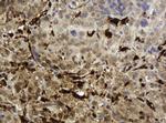 TYMP Antibody in Immunohistochemistry (Paraffin) (IHC (P))