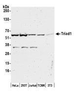 Triad1 Antibody in Western Blot (WB)