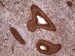 UBE2D2 Antibody in Immunohistochemistry (Paraffin) (IHC (P))