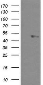 UBOX5 Antibody in Western Blot (WB)