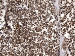 UCHL1 Antibody in Immunohistochemistry (Paraffin) (IHC (P))