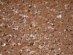 UCHL1 Antibody in Immunohistochemistry (Paraffin) (IHC (P))