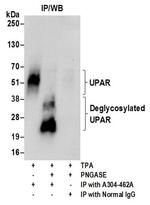 UPAR Antibody in Western Blot (WB)