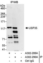 USP35 Antibody in Immunoprecipitation (IP)