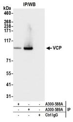 VCP Antibody in Western Blot (WB)