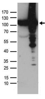 VCP Antibody in Western Blot (WB)