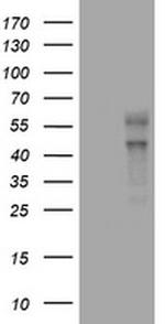 VEGFC Antibody in Western Blot (WB)