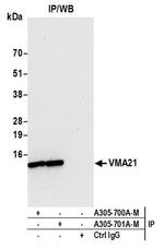 VMA21 Antibody in Western Blot (WB)