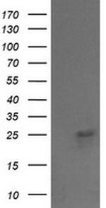 VPS28 Antibody in Western Blot (WB)