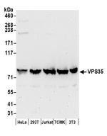 VPS35 Antibody in Western Blot (WB)