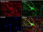 VSNL1 Antibody in Immunocytochemistry (ICC/IF)