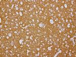 VSNL1 Antibody in Immunohistochemistry (Paraffin) (IHC (P))