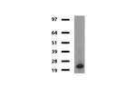 VSNL1 Antibody in Western Blot (WB)