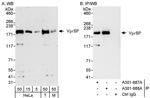 VprBP Antibody in Western Blot (WB)