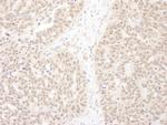 WDR5 Antibody in Immunohistochemistry (IHC)