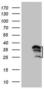 WIBG Antibody in Western Blot (WB)